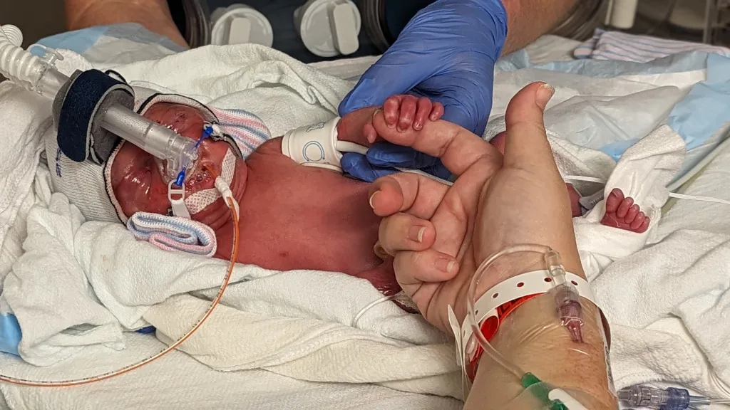 Charli during her NICU stay.